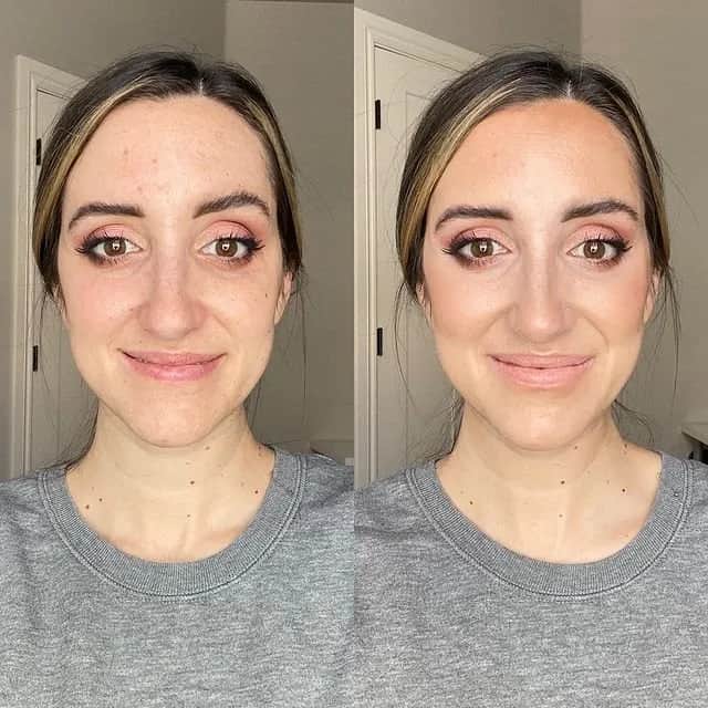 Jak skutecznie pozbyć się tłustej cery – sprawdzone metody i porady