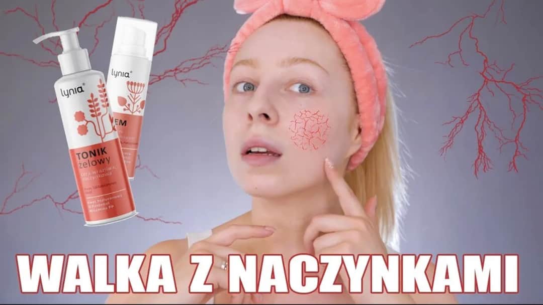 Jaki kwas do cery naczynkowej? Najlepsze opcje dla wrażliwej skóry