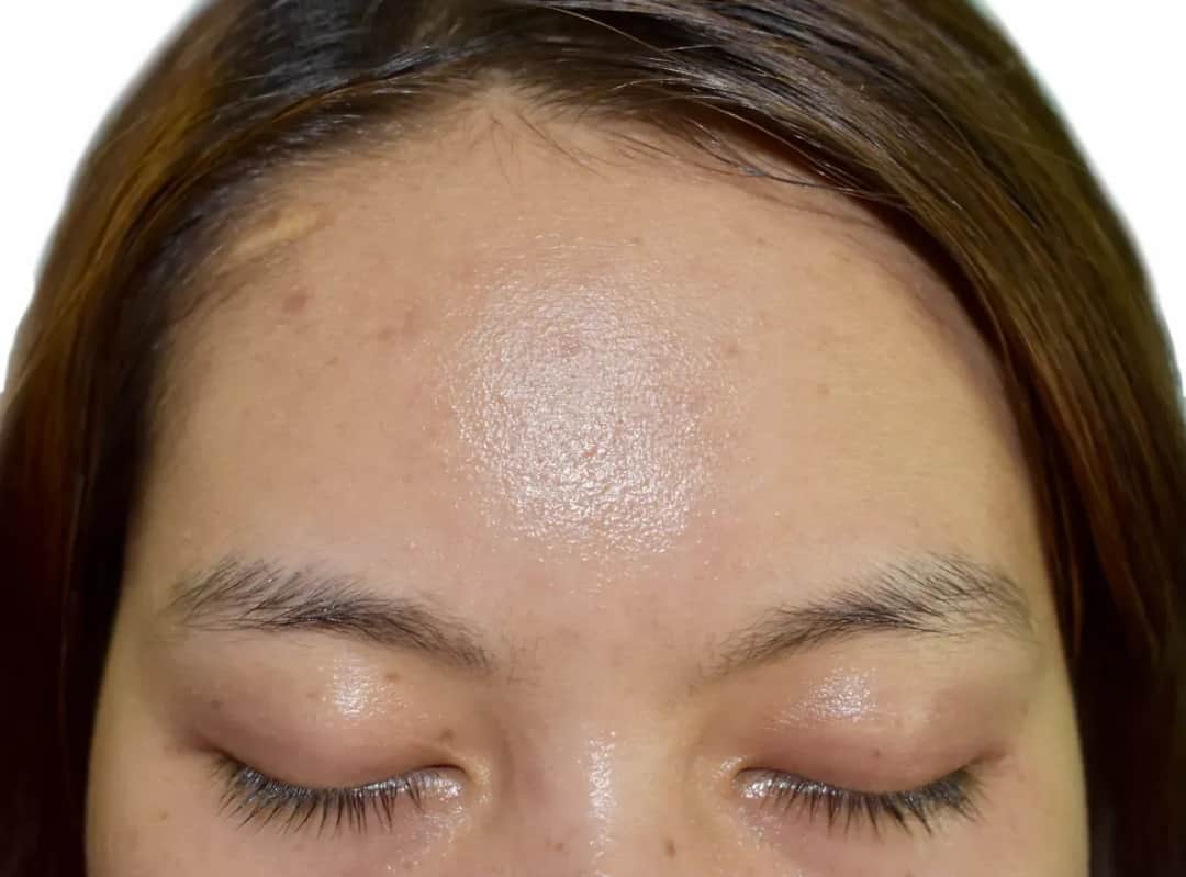 Jak dbać o cerę tłustą, aby uniknąć problemów i błyszczenia skóry