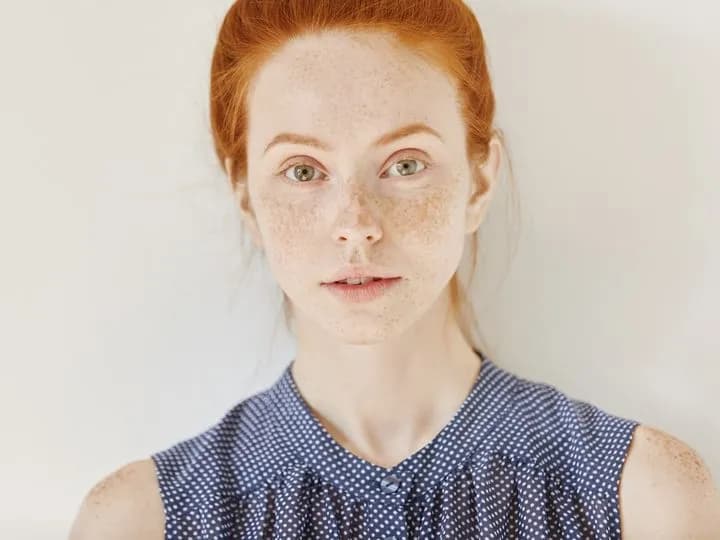 Jak wybielić piegi na twarzy: Skuteczne metody domowe i profesjonalne